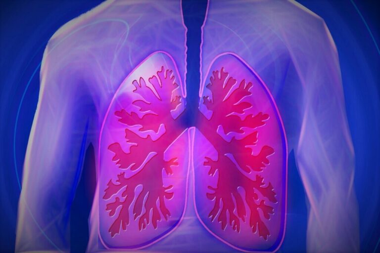 Obrázek článku I plíce mohou mít vysoký tlak, varují lékaři. Včasná diagnóza je v boji s nemocí klíčová
